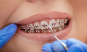 Orthodontics