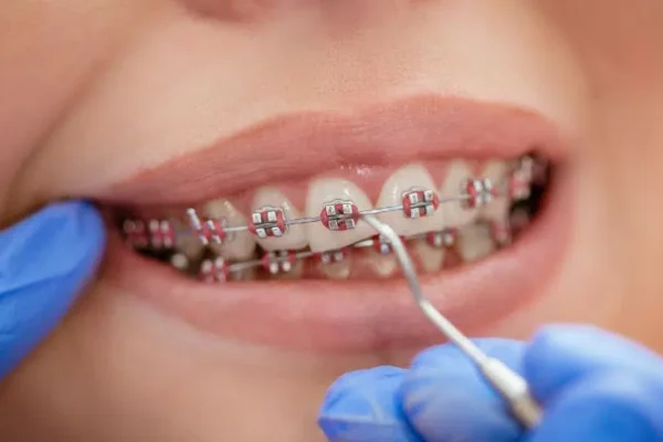 Orthodontics